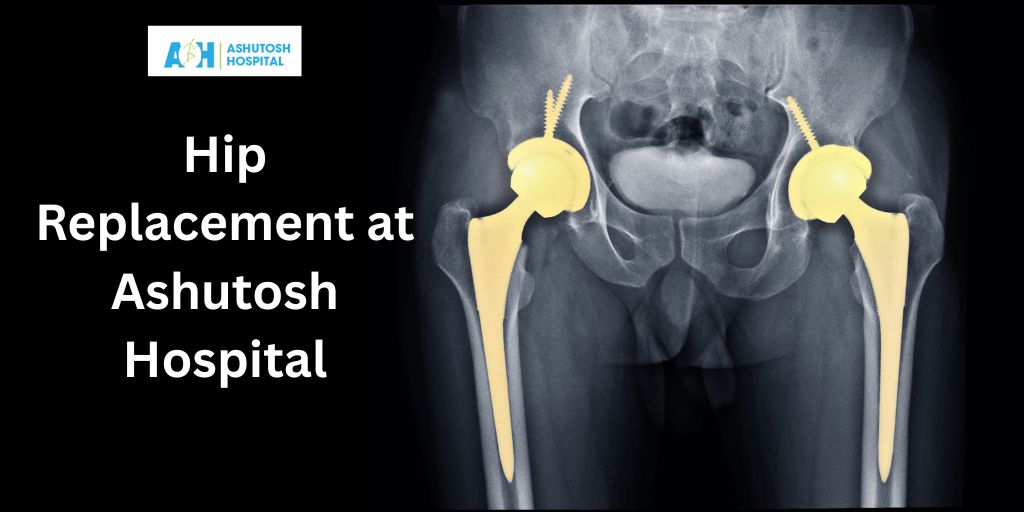 hip replacement surgery hospital in vadodara