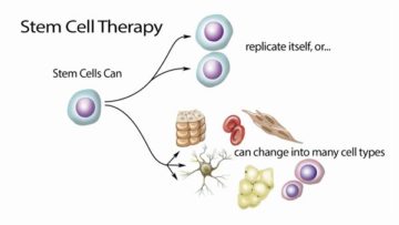 StemCell Therapy