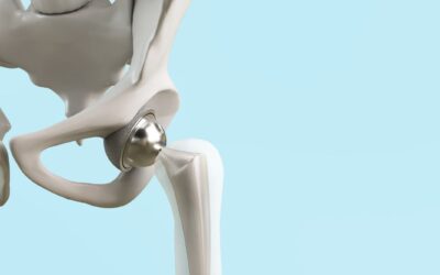 Hip Replacement Surgery Hospital In Vadodara