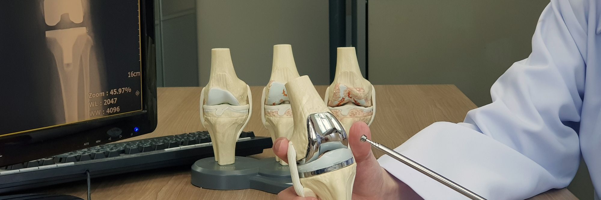 Microplasty Advanced Knee Replacement Surgery in Vadodara