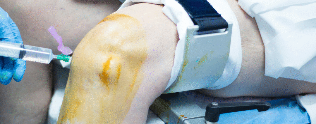 Best Knee Replacement Surgeon in Vadodara – Ashutosh Hospital